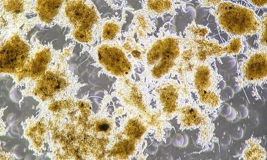Umrüstung von konventionellen Belebtschlamm-Verfahren